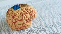A Brain model on top pf an EEG print out